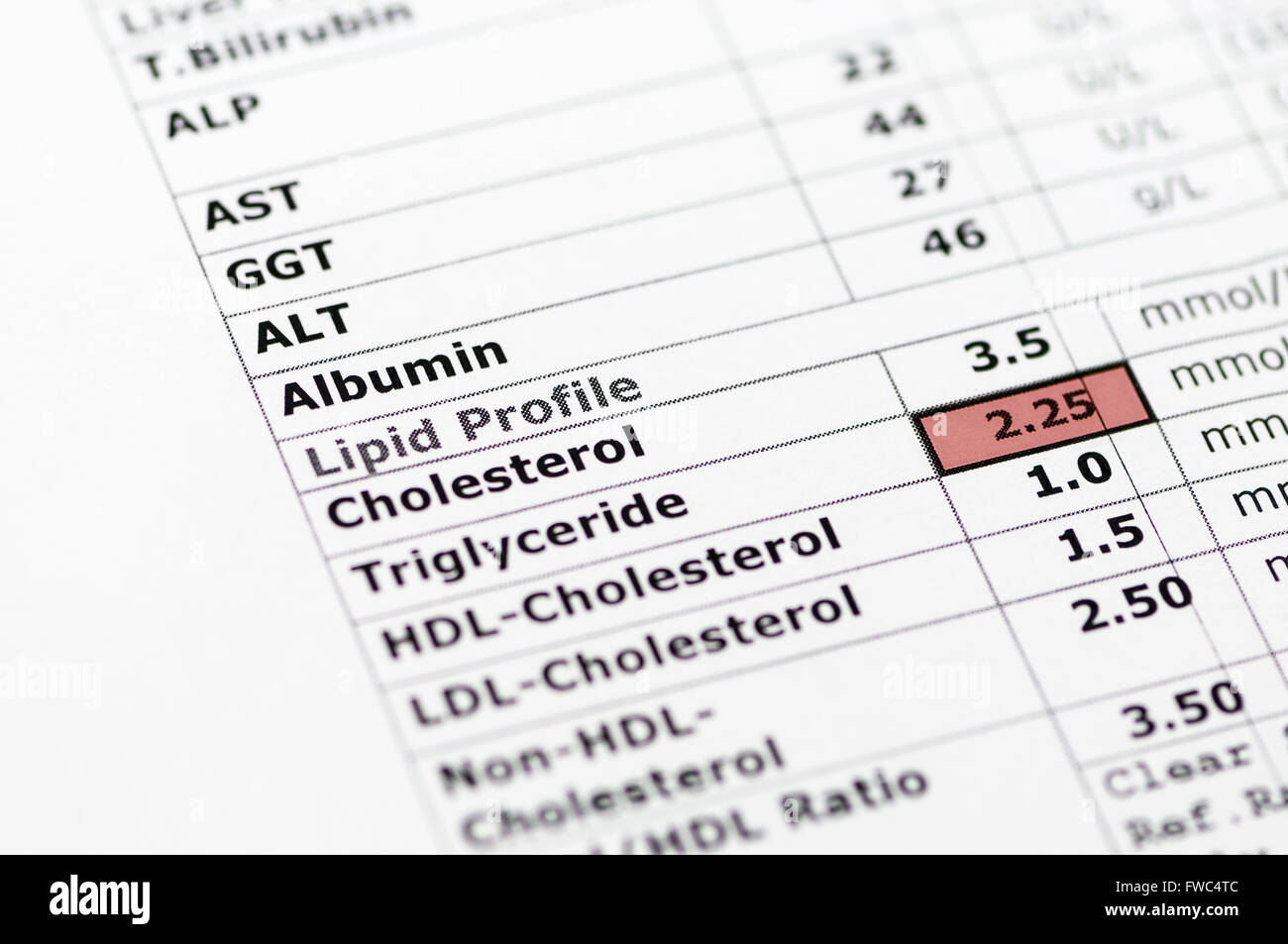 Blood chemistry report showing normal liver function tests, and a lipid profile with high triglyceride levels. Stock Photo