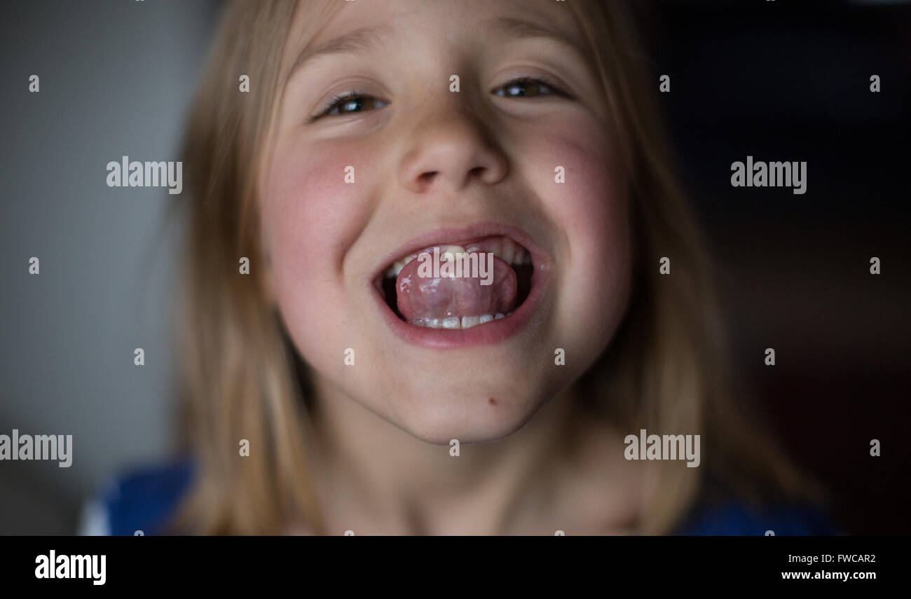 A 7-year-old girl shows off her loose teeth Stock Photo