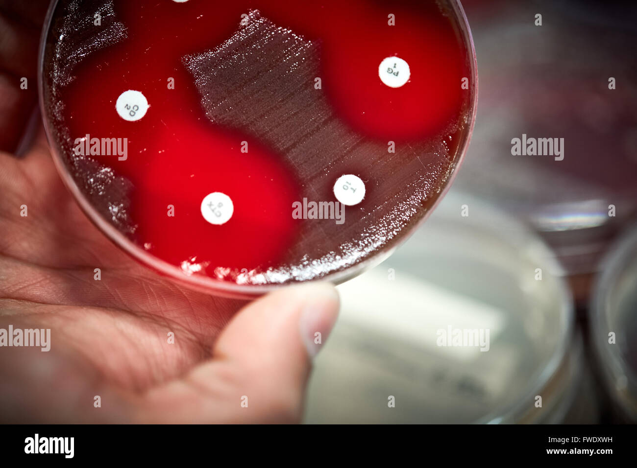 blood plates testing antibiotics     liquids samples lab laboratory laboratory testing tests patient analysing analysed serum bl Stock Photo