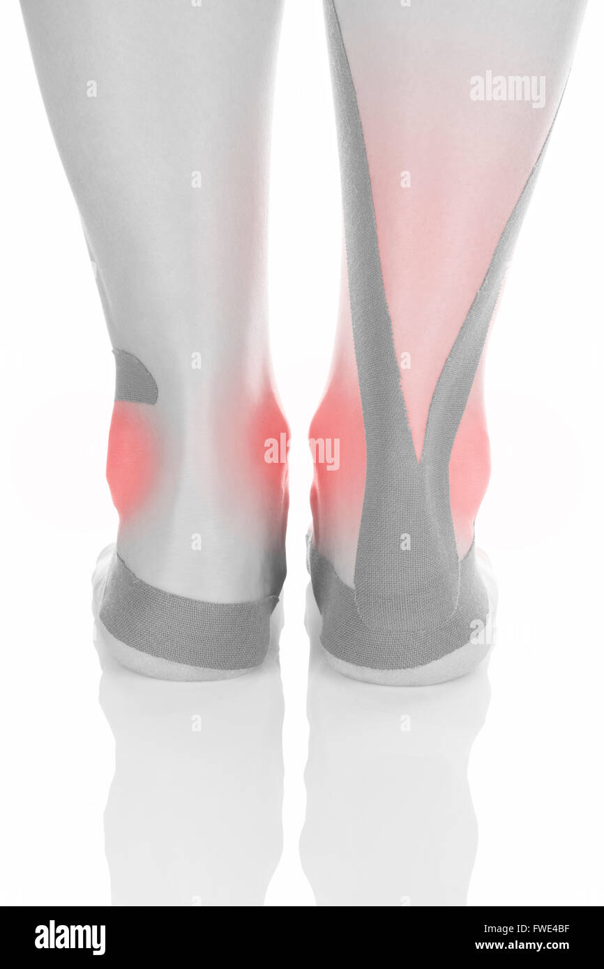 Therapeutic tape on female heel isolated on white background. Chronic pain, alternative medicine. Rehabilitation and physiothera Stock Photo