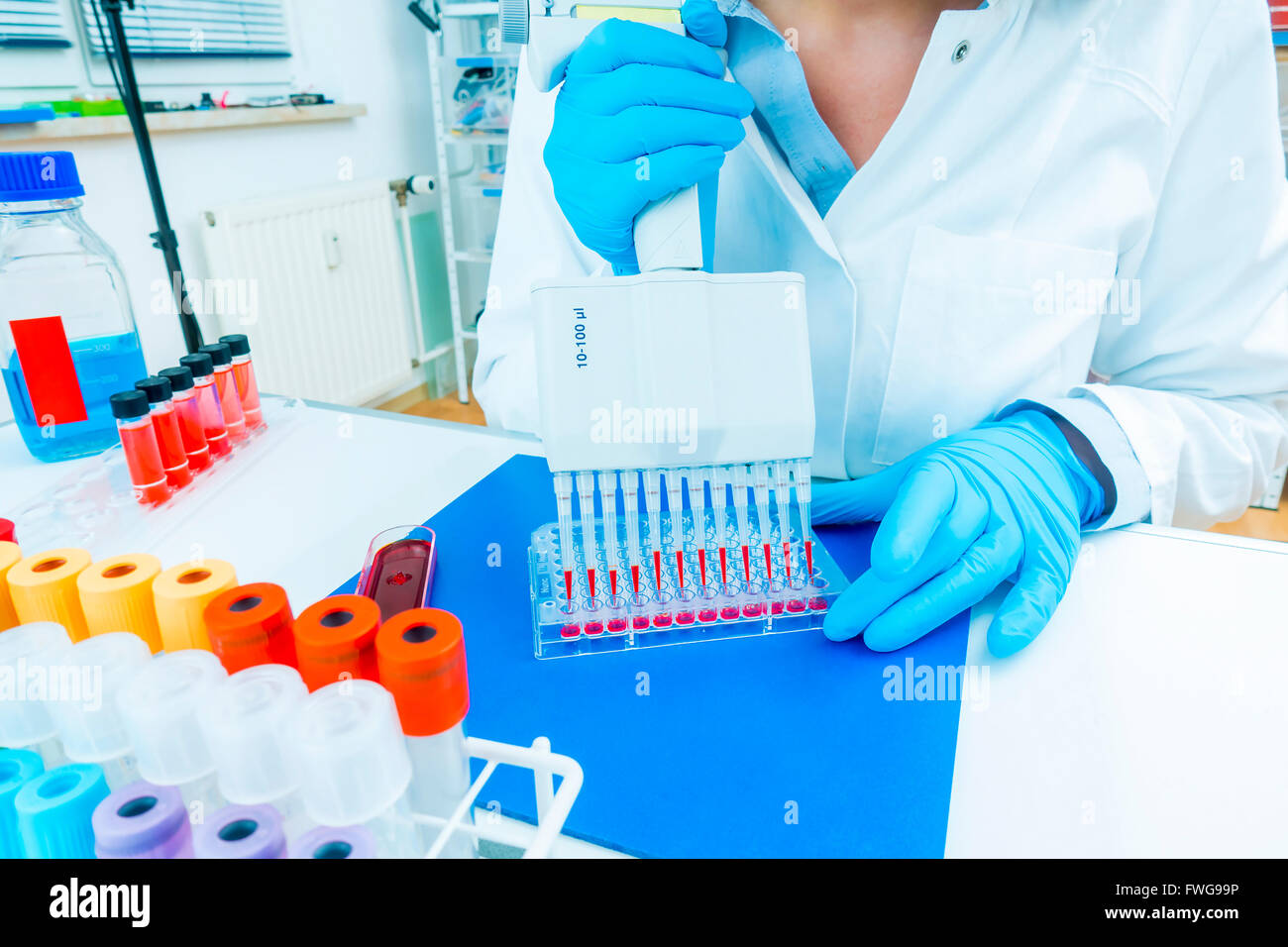 серологические исследования ифа. ифа экспресс метод. серологические исследования ифа. серологические исследования ифа. рск, рнга, ифа.