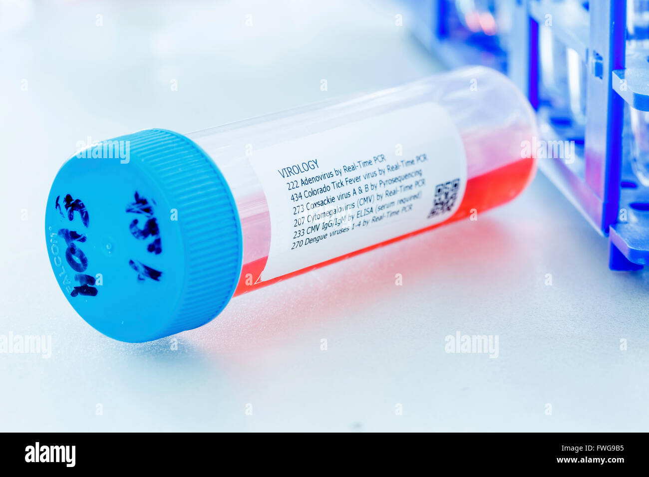 Virology test tube containing blood sample. Stock Photo