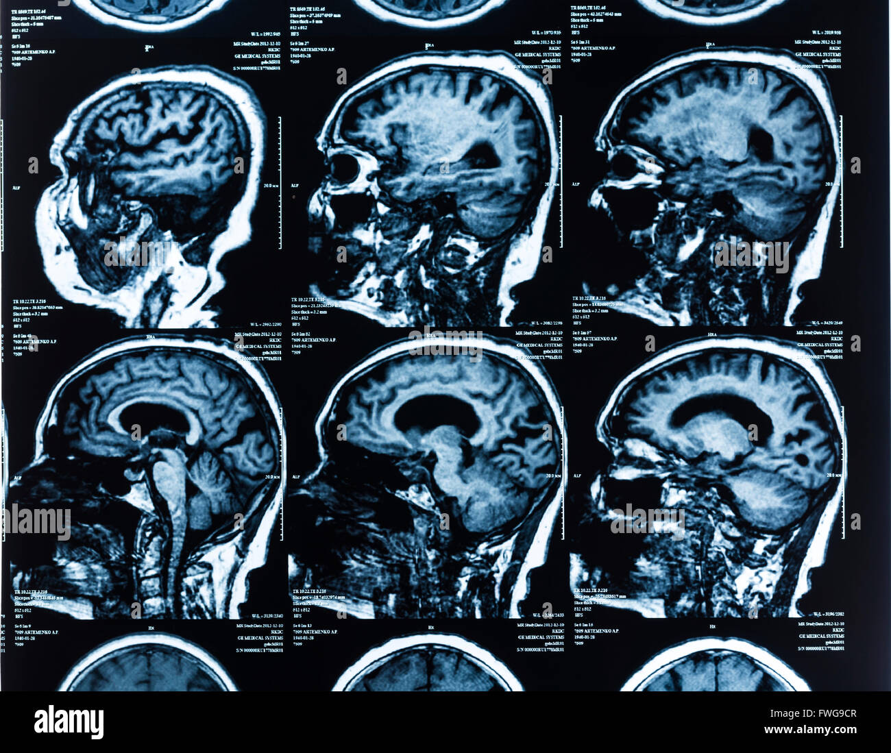 Resonance Imaging Mri Of A Section Through A Human Head My