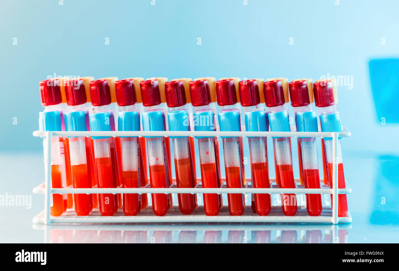 Blood samples in vacutainer tubes against a blue background Stock Photo Alamy
