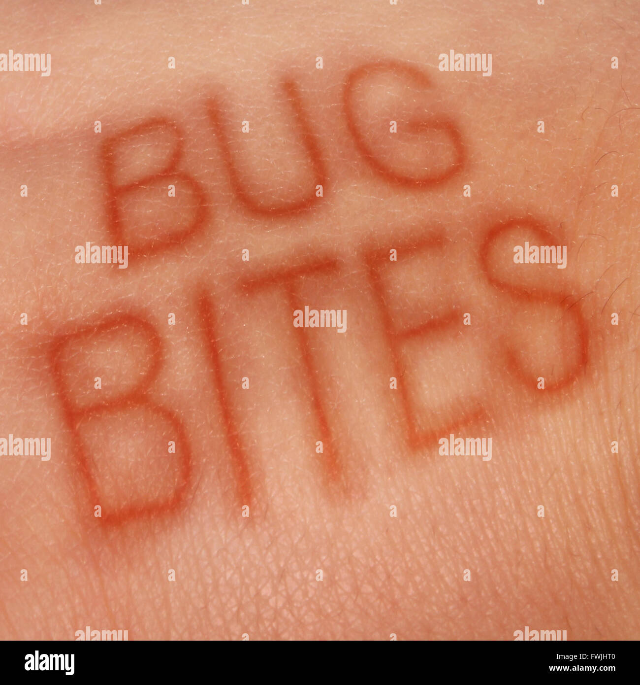 Bug bites medical concept and health care symbol for insect bite infection or skin irritation as human epidermis with text shaped with sores as for lym disease or dengue fever or zika virus and malaria. Stock Photo