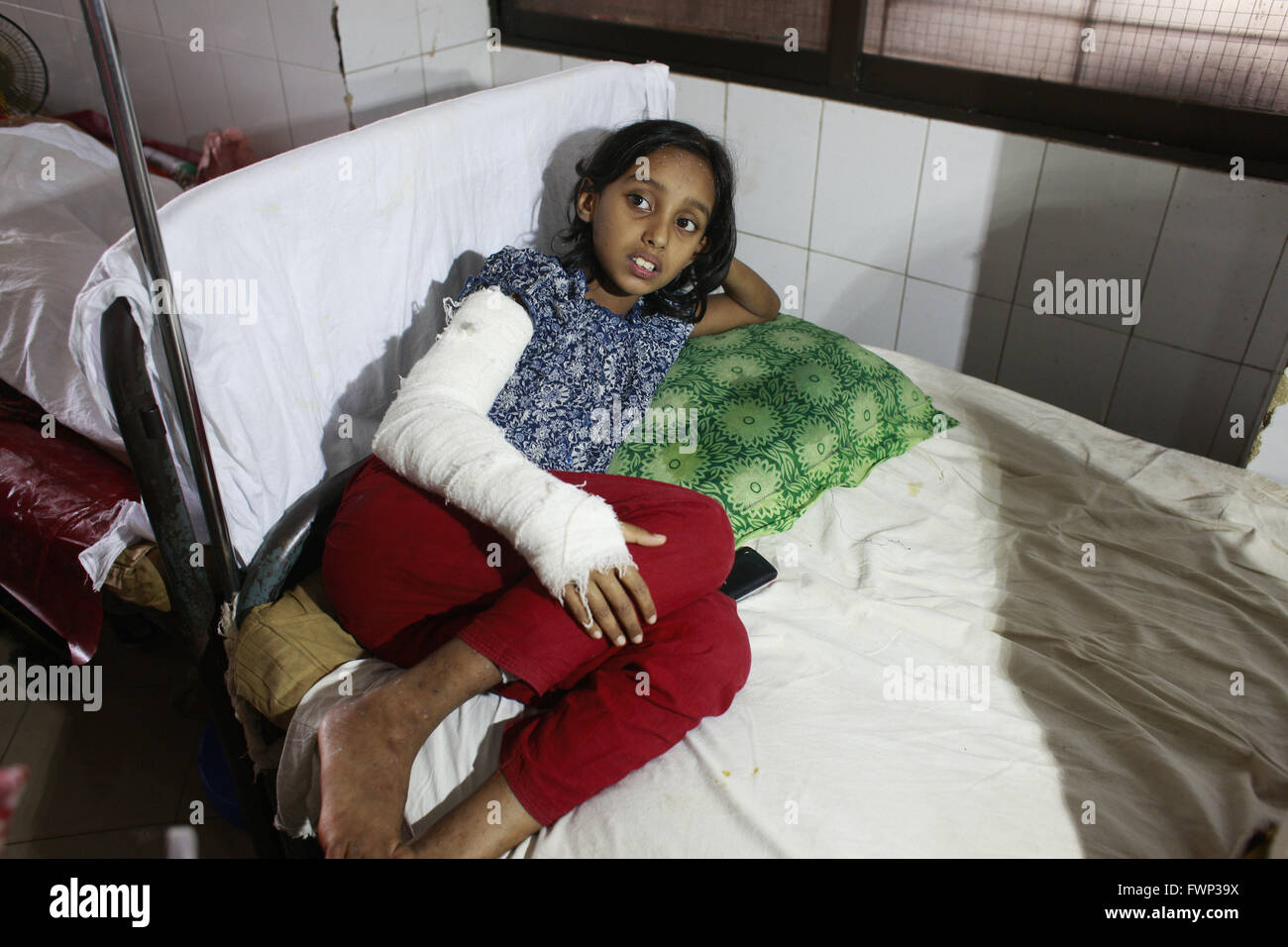Dhaka, Bangladesh. 7th Apr, 2016. Acid attack victim Sanjida Sultana Reema, 9, lays on a hospital bad in Dhaka, Bangladesh, April 7, 2016. Unidentified miscreants splashed a family with deadly acid at Dhaka's Mirpur, leaving four including three women badly burnt. The victims were rushed to the Burn Unit of the Dhaka Medical College Hospital (DMCH) after the early morning acid attack on Thursday, said police. Credit:  ZUMA Press, Inc./Alamy Live News Stock Photo