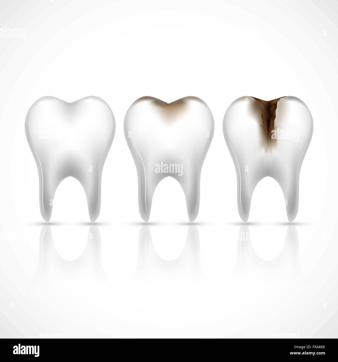 Teeth realistic set Stock Vector Image & Art - Alamy