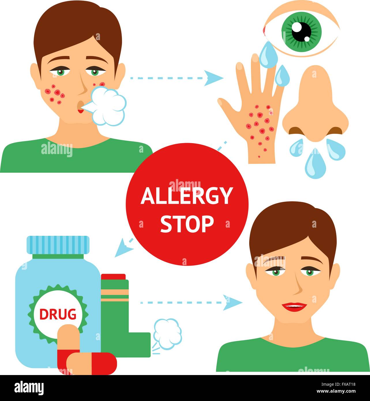 Allergy Prevention Concept Stock Vector Image & Art Alamy
