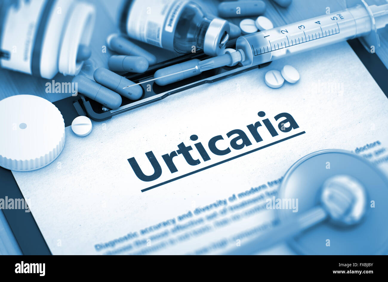 Urticaria Diagnosis. Medical Concept. Stock Photo