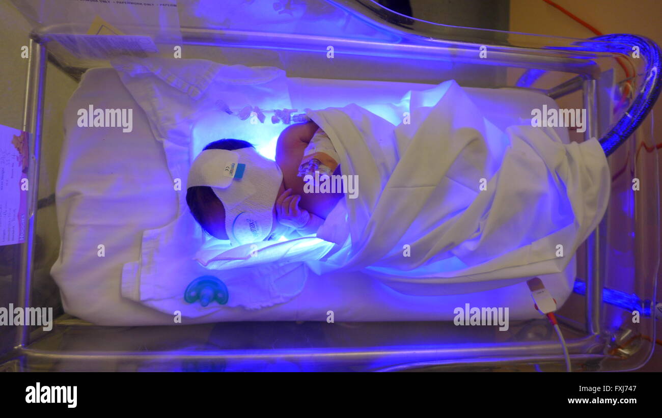 Baby Intensive Care Unit UV Light Treatment Stock Photo