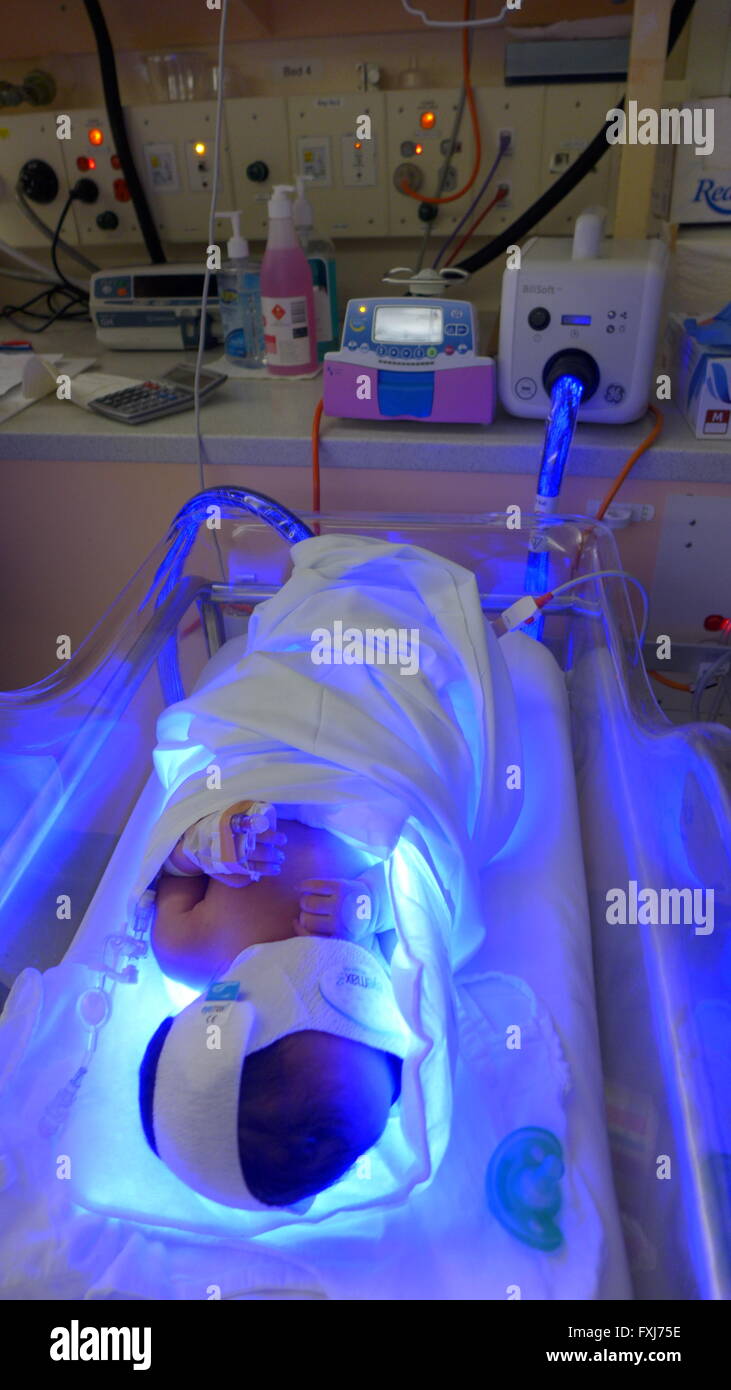 Baby Intensive Care Unit UV Light Treatment Stock Photo Alamy