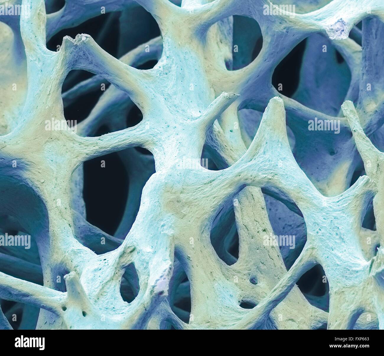 Bone tissue. Coloured scanning electron micrograph (SEM) of cancellous (spongy) bone. Bone tissue can be either cortical (compact) or cancellous. Cortical bone usually makes up the exterior of the bone, while cancellous bone is found in the interior. Cancellous bone is characterised by a honeycomb arrangement, comprising a network of trabeculae (rod-shaped tissue). These structures provide support and strength to the bone. The spaces within this tissue contain bone marrow (not seen), a blood forming substance. Magnification: x40 when printed 10cm wide. Stock Photo