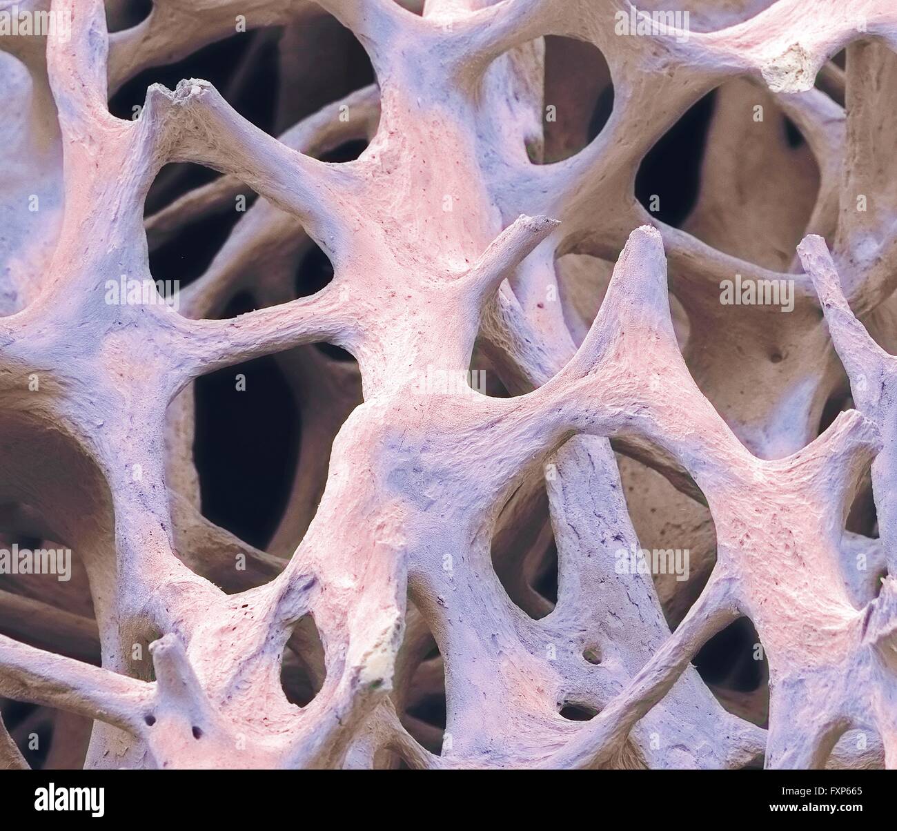 Bone tissue. Coloured scanning electron micrograph (SEM) of cancellous (spongy) bone. Bone tissue can be either cortical (compact) or cancellous. Cortical bone usually makes up the exterior of the bone, while cancellous bone is found in the interior. Cancellous bone is characterised by a honeycomb arrangement, comprising a network of trabeculae (rod-shaped tissue). These structures provide support and strength to the bone. The spaces within this tissue contain bone marrow (not seen), a blood forming substance. Magnification: x40 when printed 10cm wide. Stock Photo