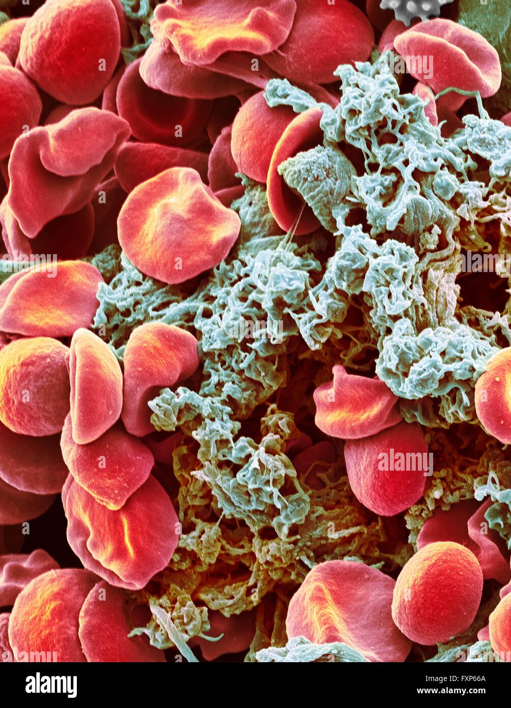 Red blood cells and platelets. Coloured scanning electon micrograph (SEM) of human erythrocytes