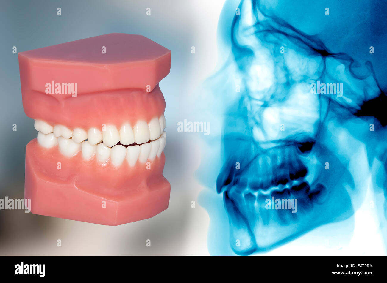 Orthodontic hires stock photography and images Alamy