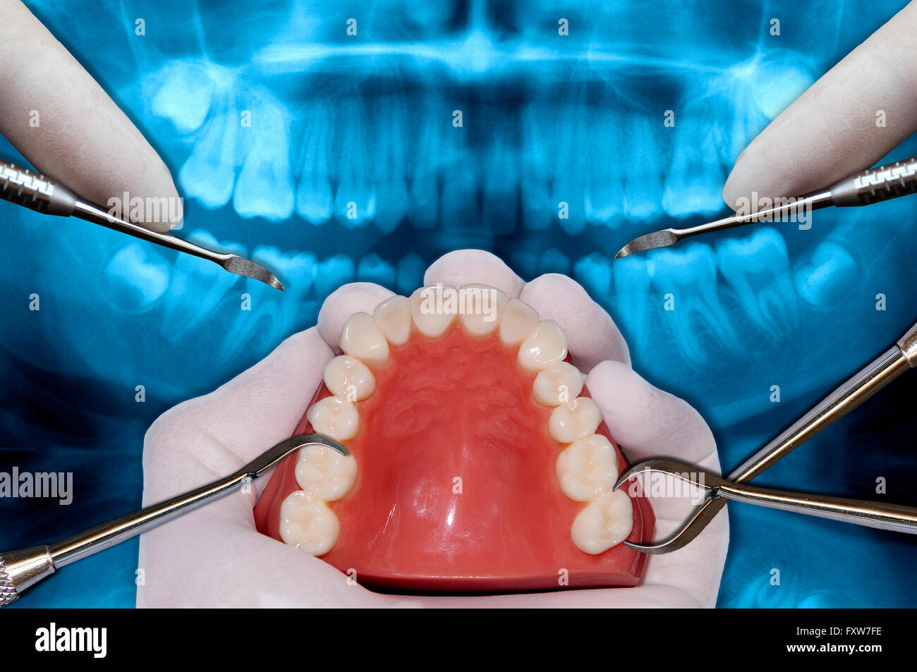 surgery simulation with orthodontics tools Stock Photo
