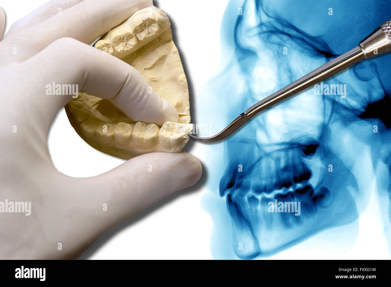 dentist show molar teeth over dental scan x-ray Stock Photo