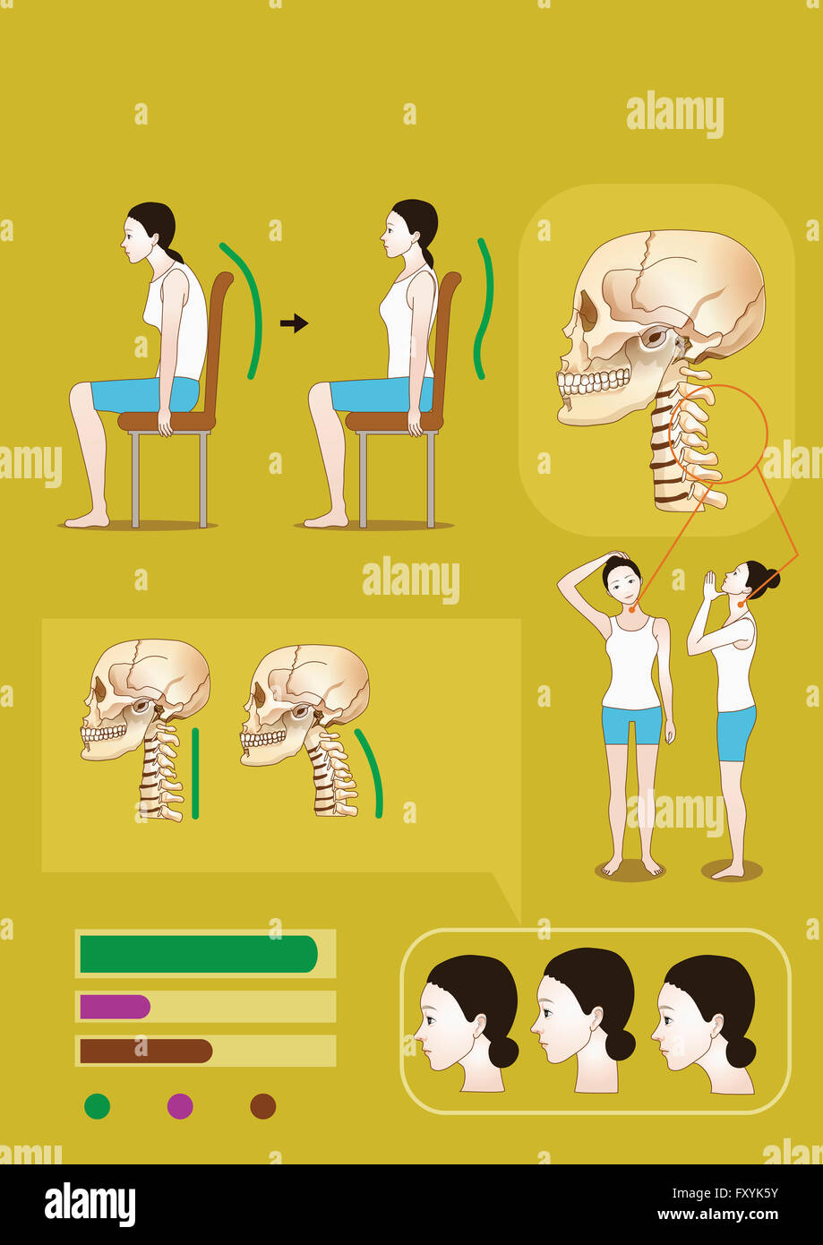 Illustration representing neck disk and bent neck correction Stock