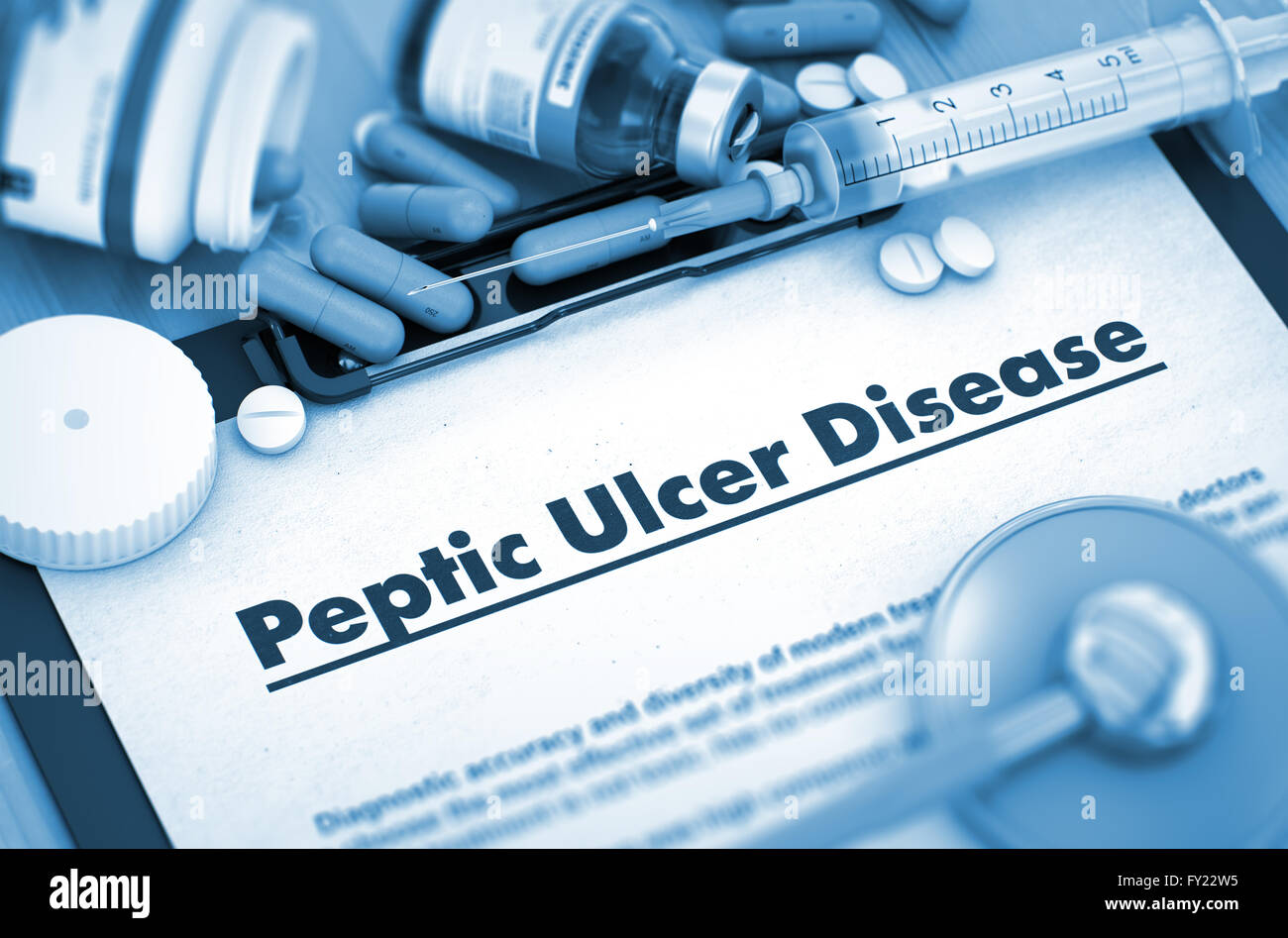 Peptic Ulcer Disease Diagnosis. Medical Concept. 3D. Stock Photo