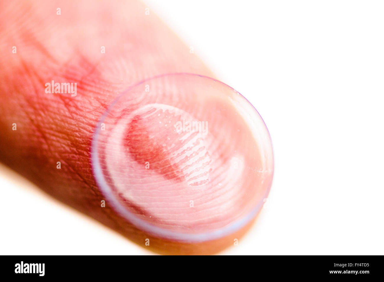 A contact lens on a fingertip ready to be inserted into an eye. Stock Photo