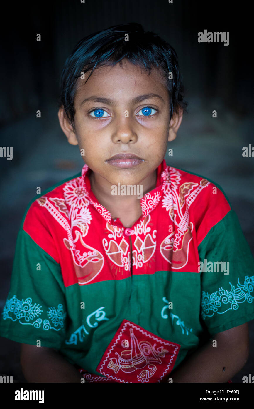 Rizvi 8 Years old, a child with rare blue eyes in Bangladesh Stock Photo -  Alamy