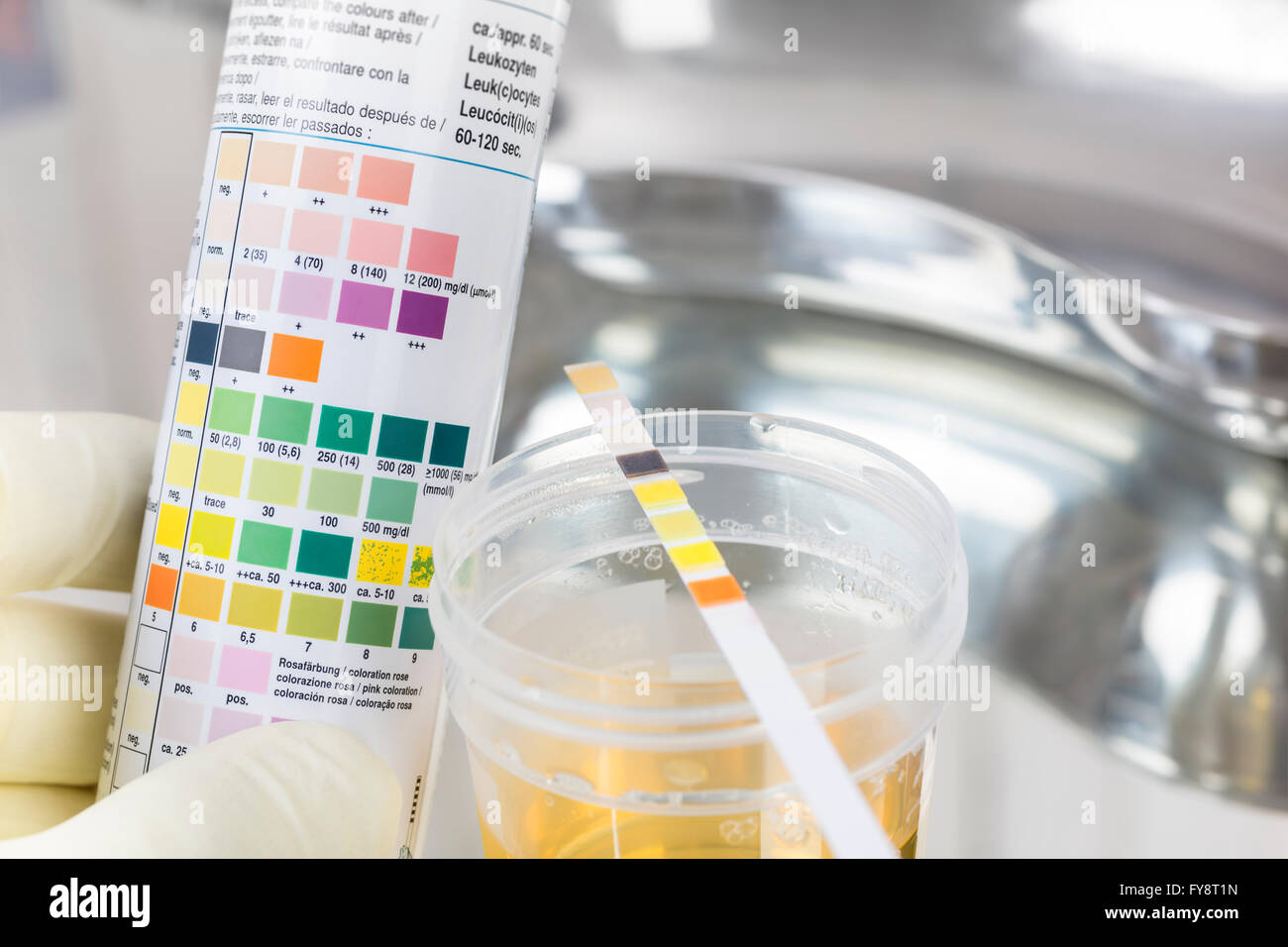 Routine test, urine rapid test, urine test strip, urine sample Stock