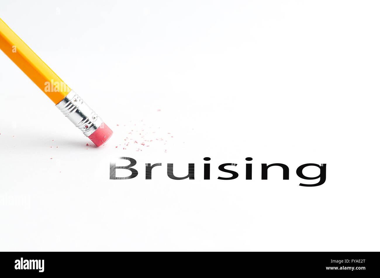 Bruises hires stock photography and images Alamy