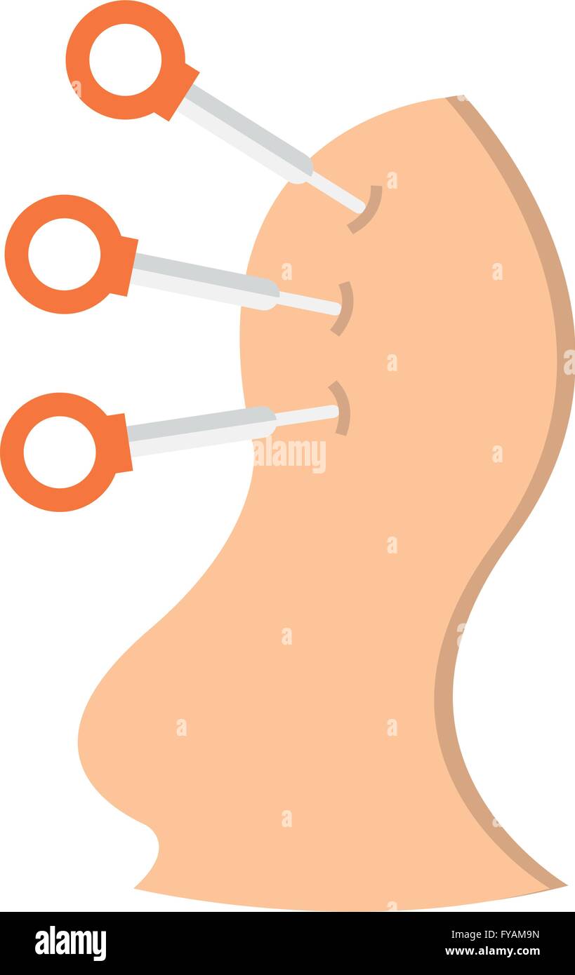 Tcm patient Stock Vector Images - Alamy
