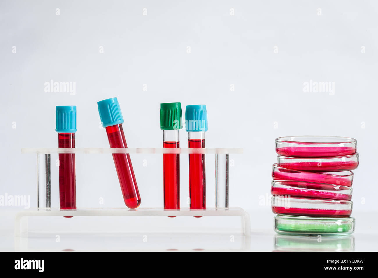 Bacterial culture tubes hires stock photography and images Alamy