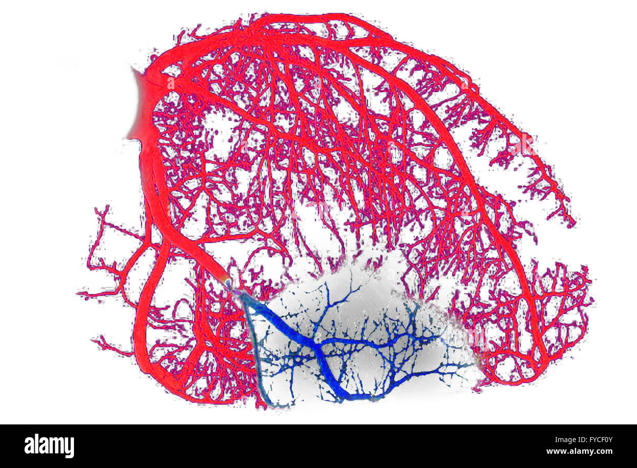 Infarctus Rouge MYOCARDIAL INFARCTION, ILLUSTRATION Stock Photo - Alamy