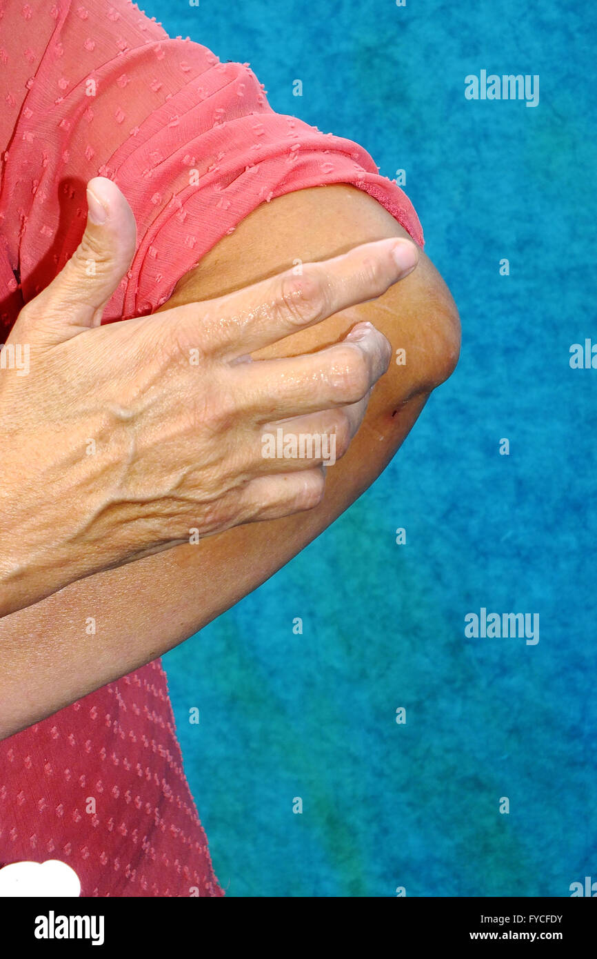 Ointment woman elbow hires stock photography and images Alamy