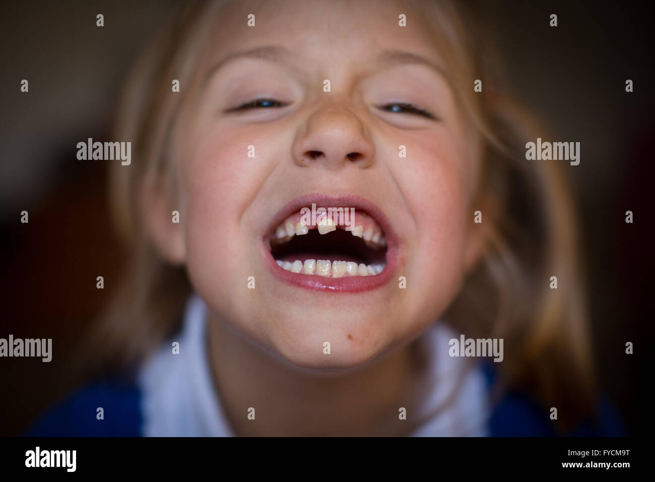 A young girl smiles as she shows off her loose tooth Stock Photo