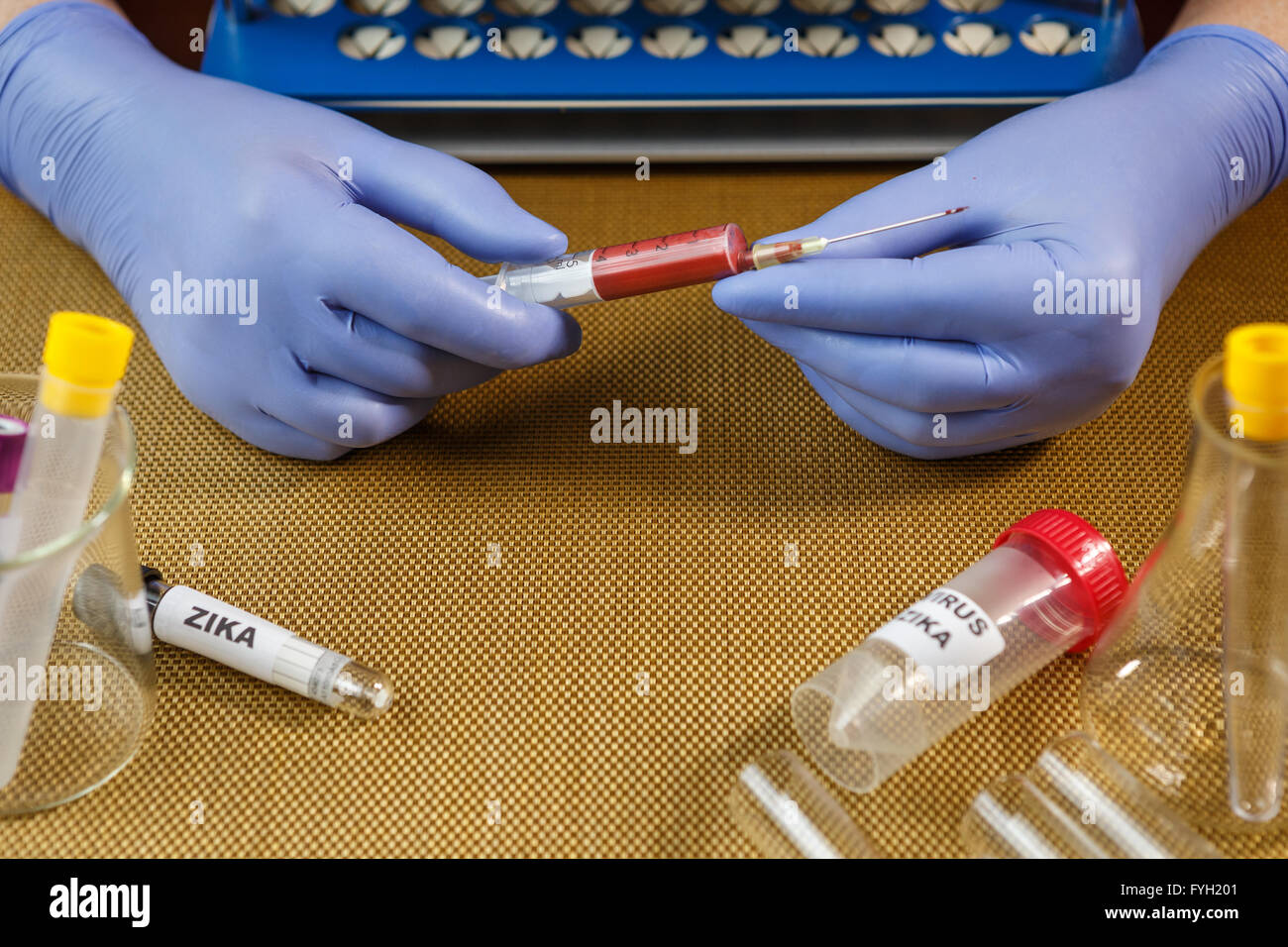 Sample blood collection tube with a suspected virus Zika Stock Photo ...