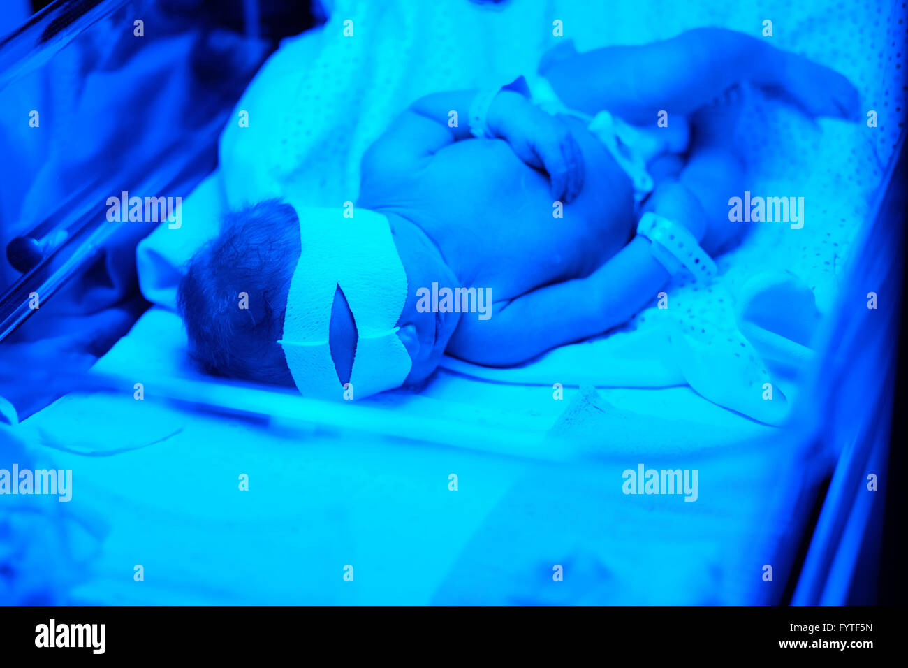 Newborn baby having photo theraphy Stock Photo