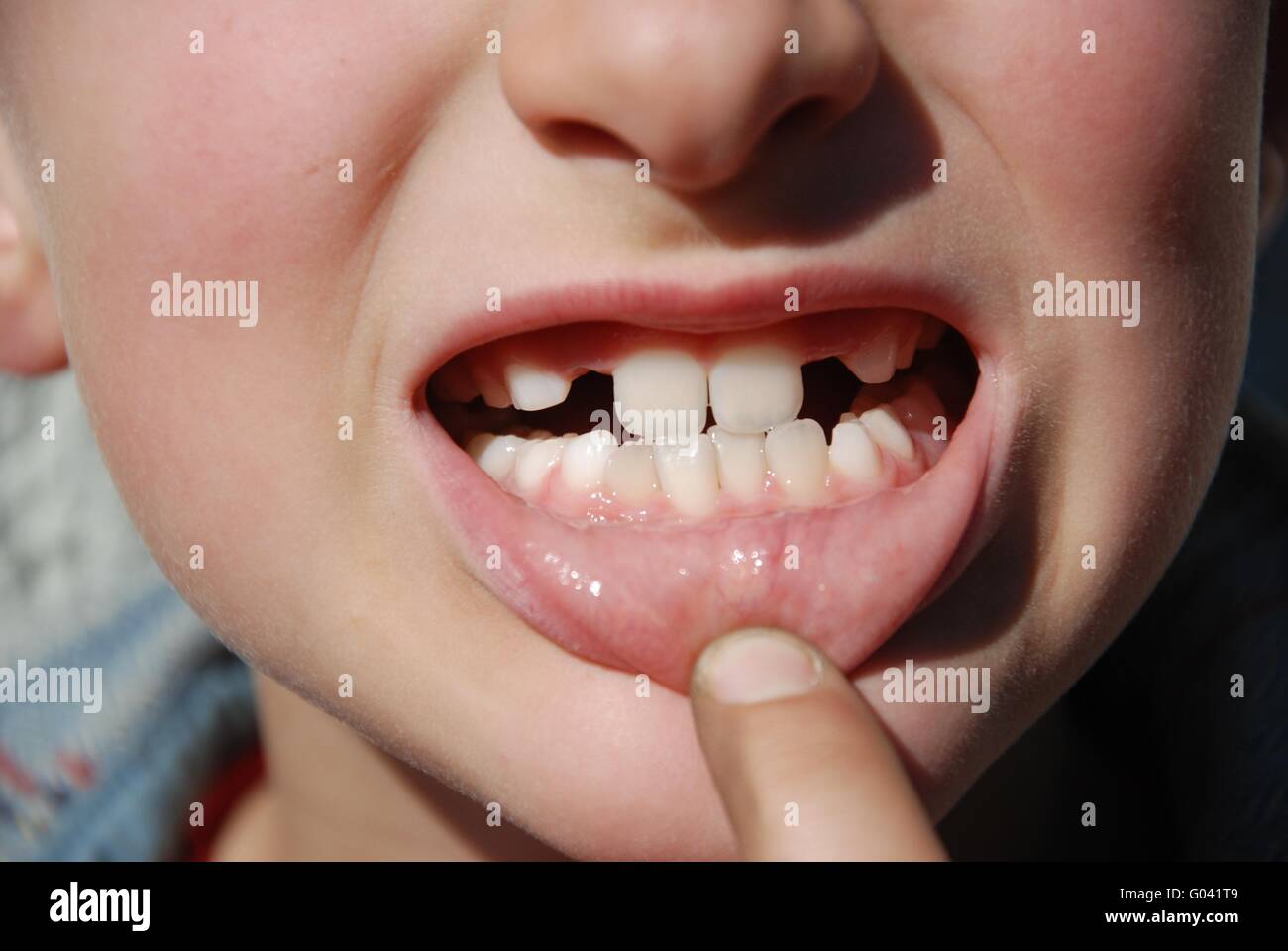 Teeth Stock Photo