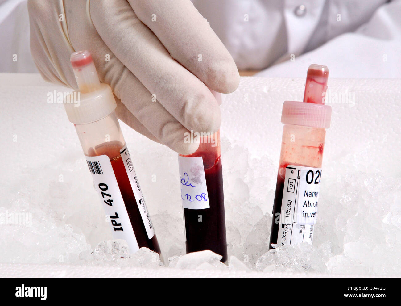 Biotechnology, blood cannula, vacutainer, blood sample, test tube, ice