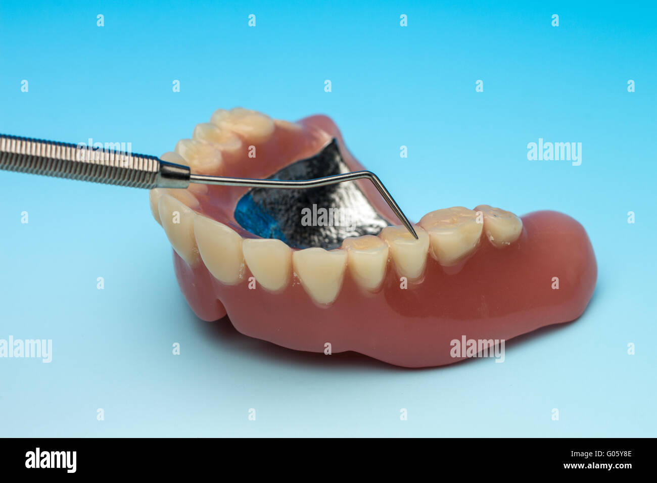 Denture teeth denture with metal base Stock Photo Alamy