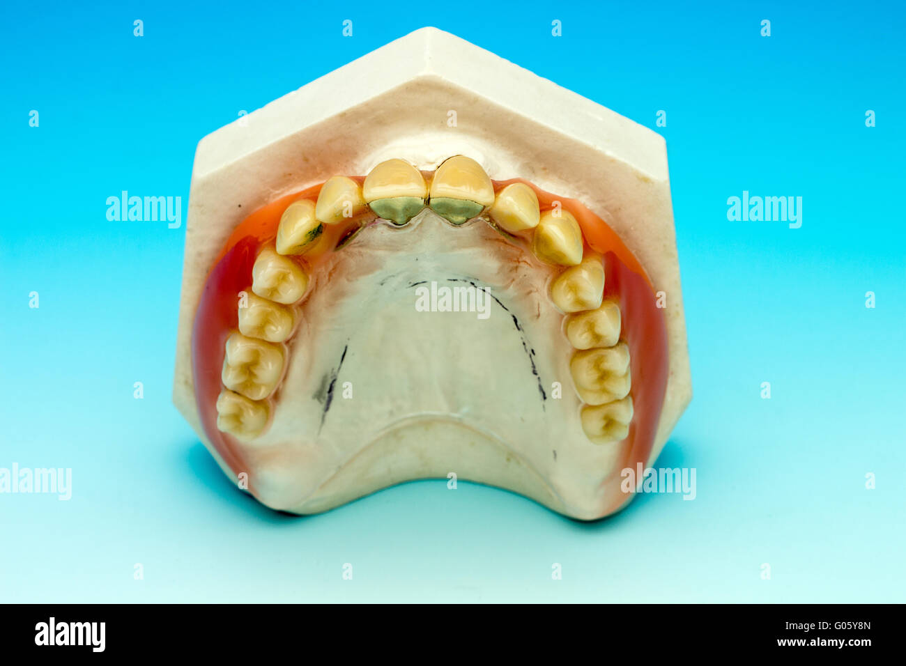 Maxillary denture tablets on Stock Photo