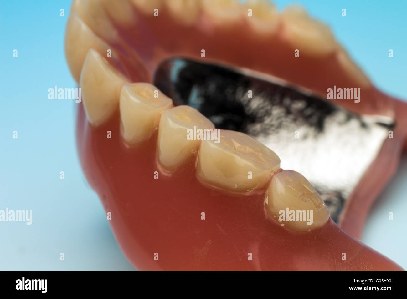 Denture teeth denture with metal base Stock Photo - Alamy