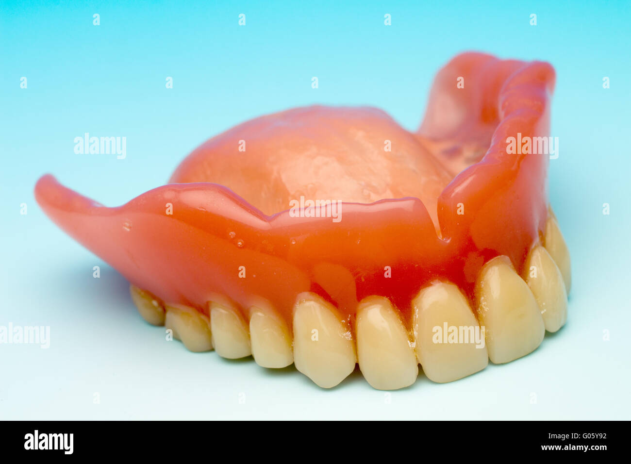 Denture teeth denture with metal base Stock Photo Alamy
