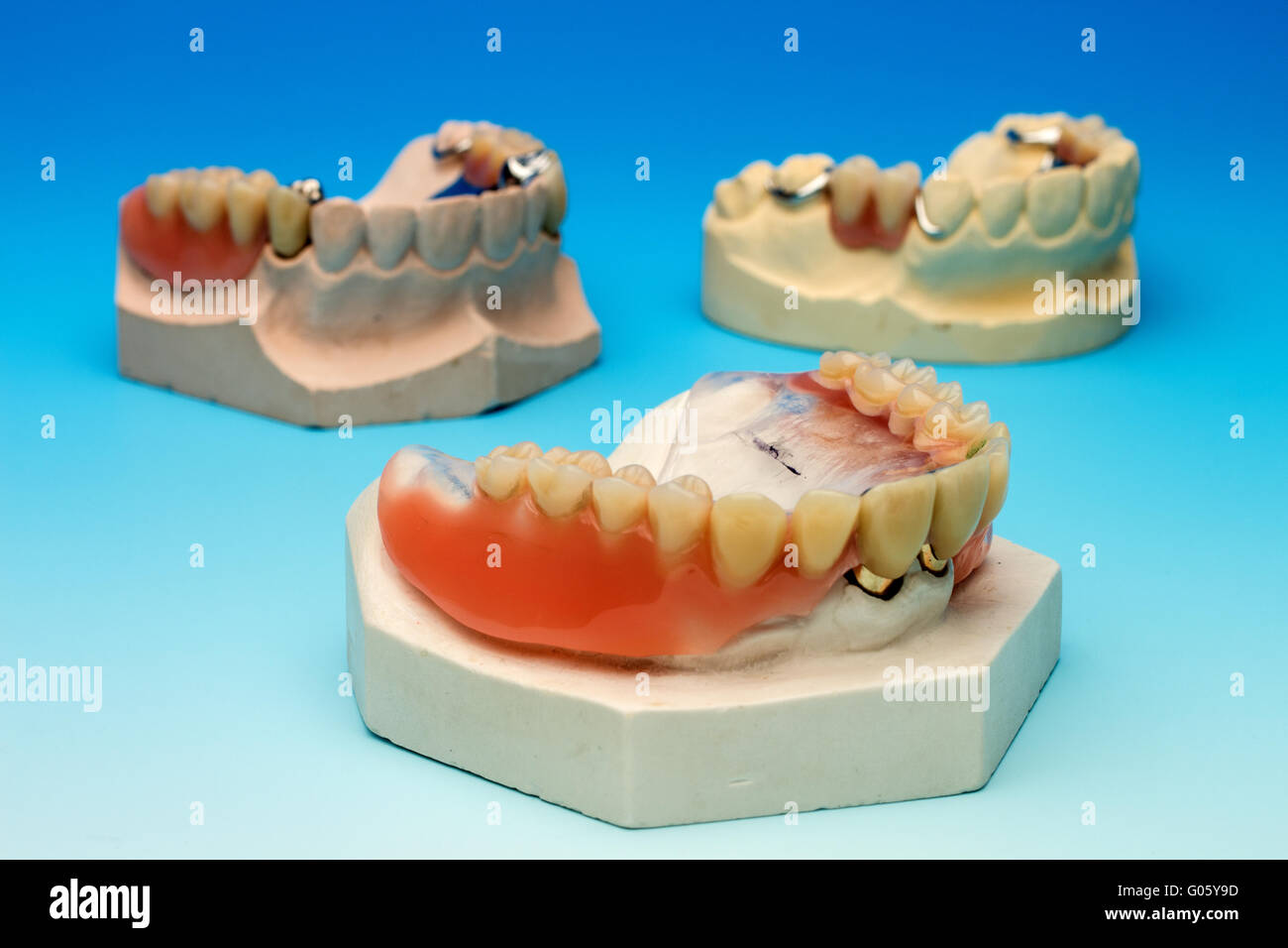 3 dentures on white blue gradient Stock Photo