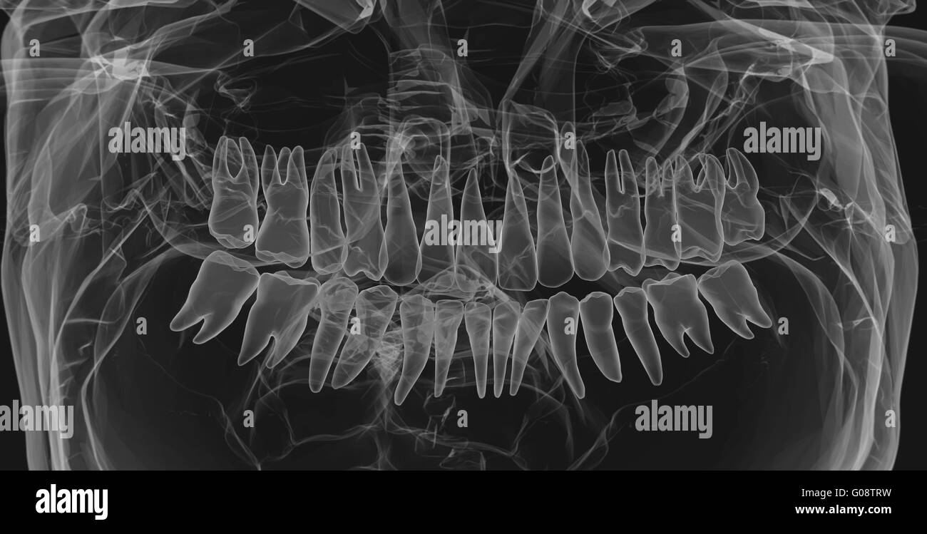 Human Teeth. X-Ray effect Stock Photo