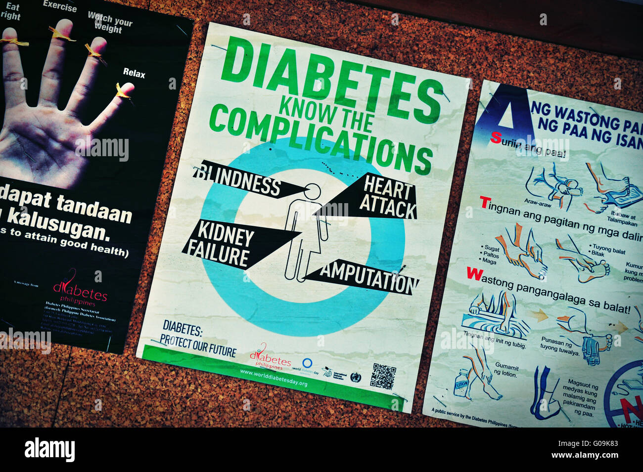 Diabetis, Hospital in Valencia, Mindanao, Philippines. Stock Photo
