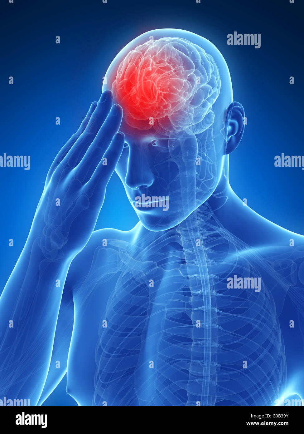 3d rendered conceptual illustration of head pain Stock Photo Alamy