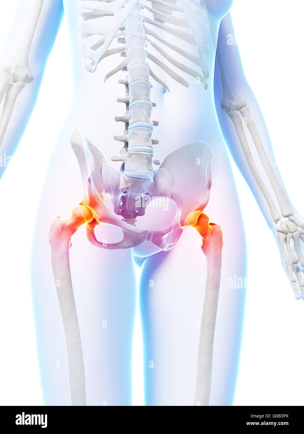 3d rendered illustration of painful hip joints Stock Photo