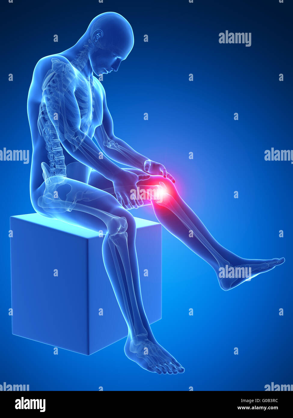 3d rendered medical illustration - painful knee Stock Photo - Alamy