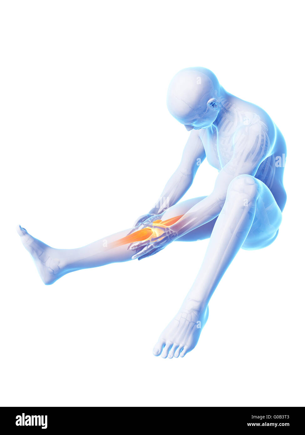 3d rendered illustration of pain in the knee Stock Photo