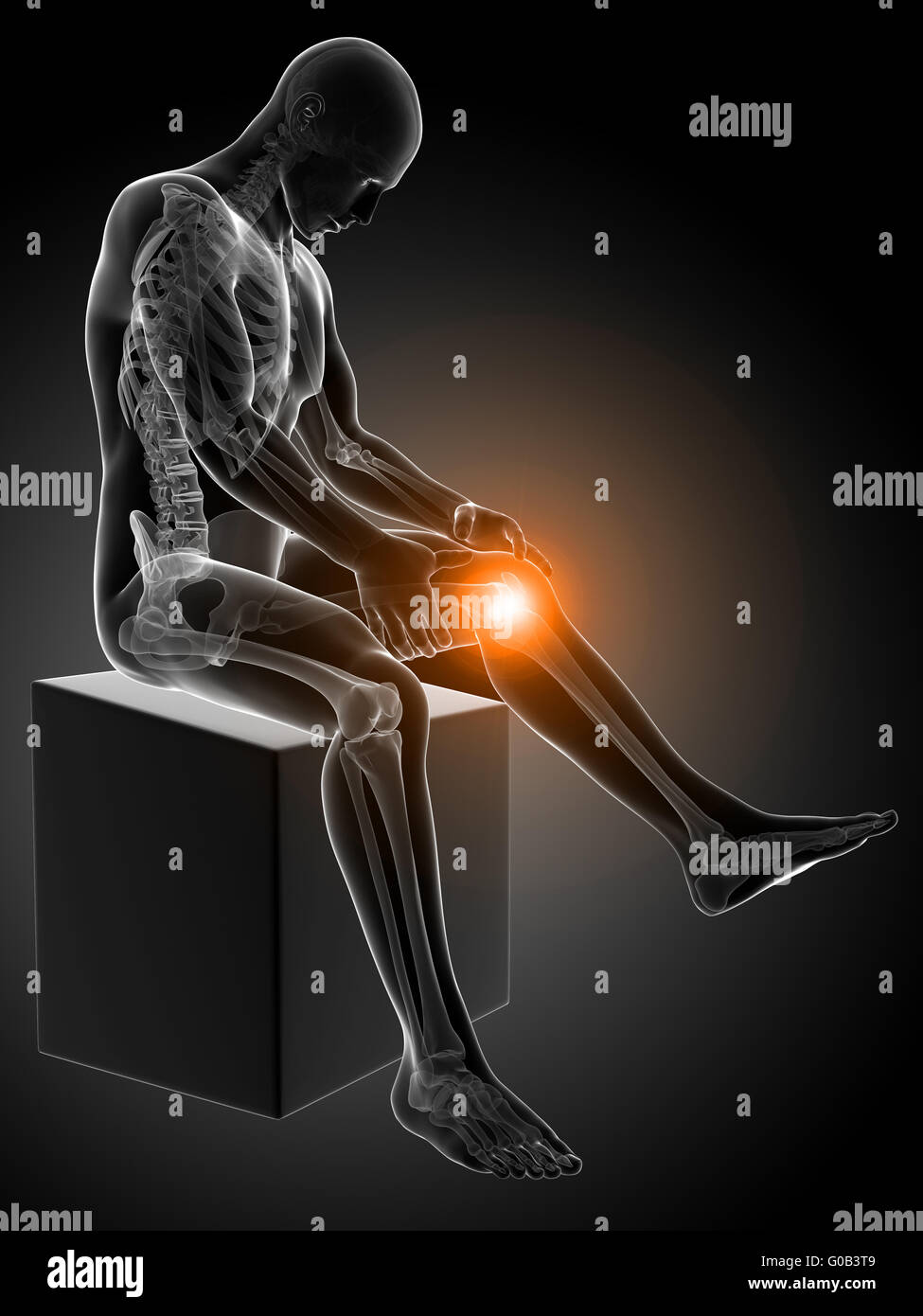 3d rendered medical illustration - painful knee Stock Photo - Alamy