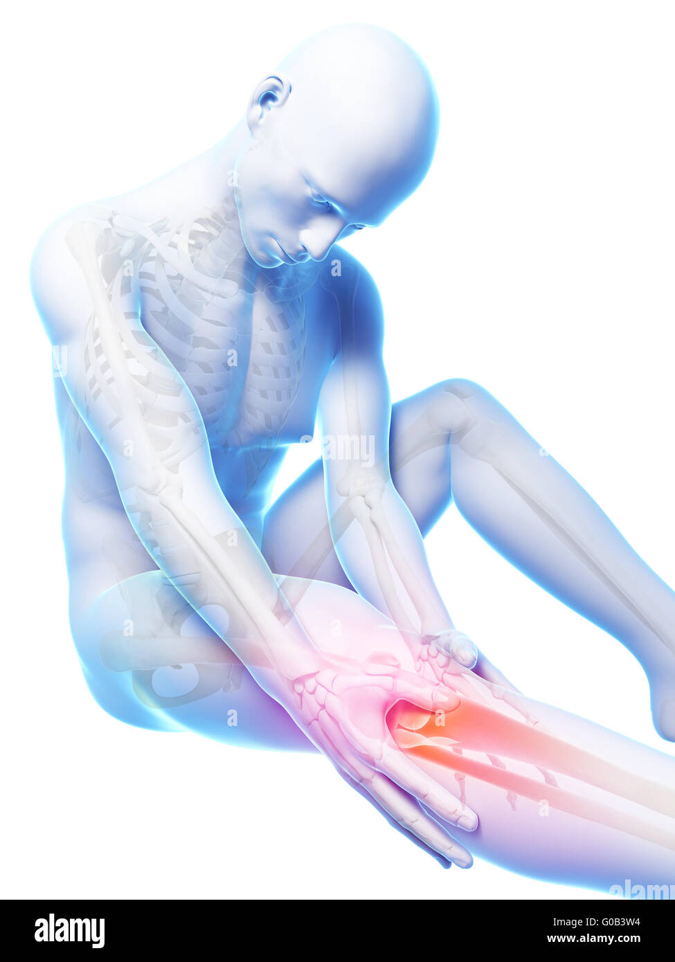 3d rendered illustration of pain in the knee Stock Photo