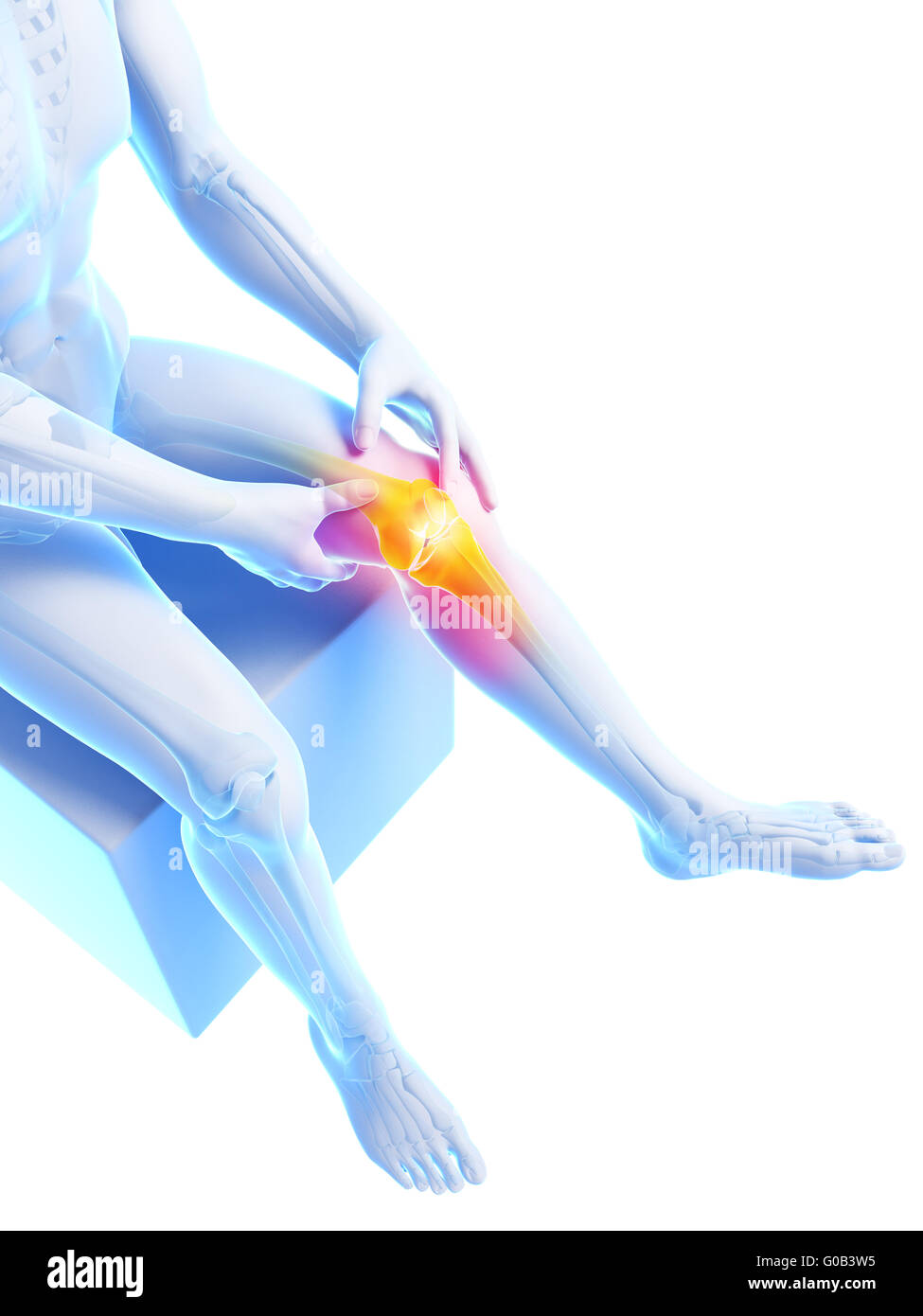 3d rendered medical illustration - painful knee Stock Photo - Alamy